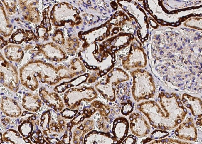 Recombinant SOD2 Monoclonal Antibody - small - 2