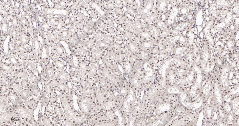 Recombinant Polycomb Protein SUZ12 Monoclonal Antibody - 3