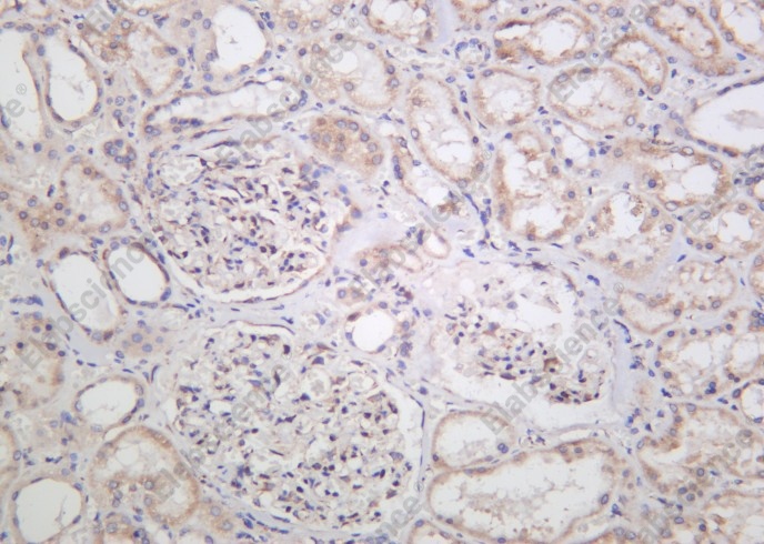 Recombinant TXD12 Monoclonal Antibody - 2