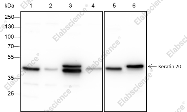 Recombinant Keratin 20 Monoclonal Antibody - 1