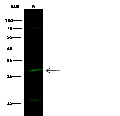 HPGD/15-PGDH Monoclonal Antibody - small - 1