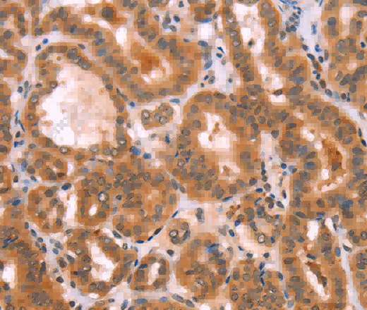 NCEH1 Polyclonal Antibody - 2