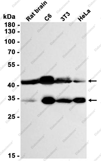 Recombinant MBD2 Monoclonal Antibody - 1