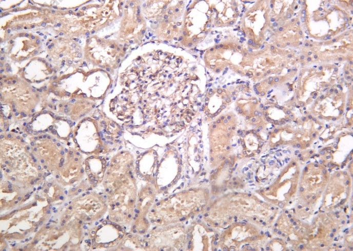 Recombinant MYH9 Monoclonal Antibody - 1