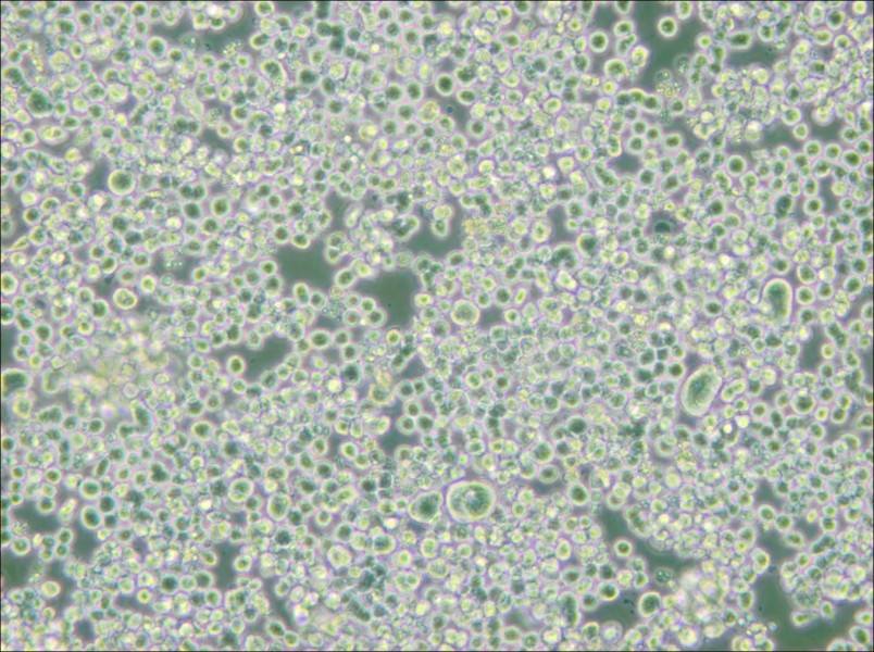 RPMI 8226 Cell Complete Medium - small - 6