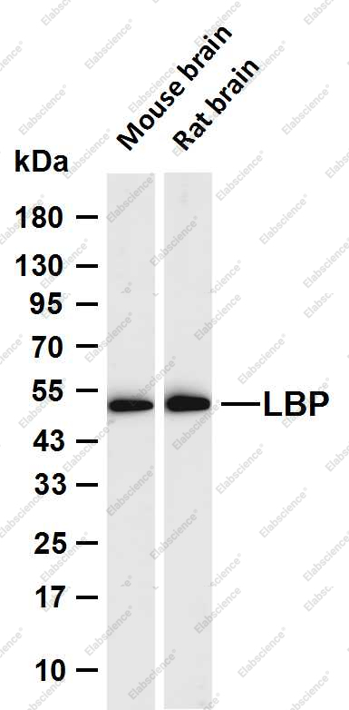 Recombinant Laminin Receptor Monoclonal Antibody - 1