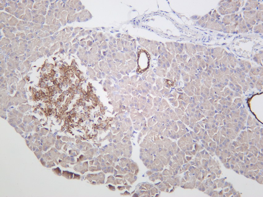 Recombinant TNF α Monoclonal Antibody - 3