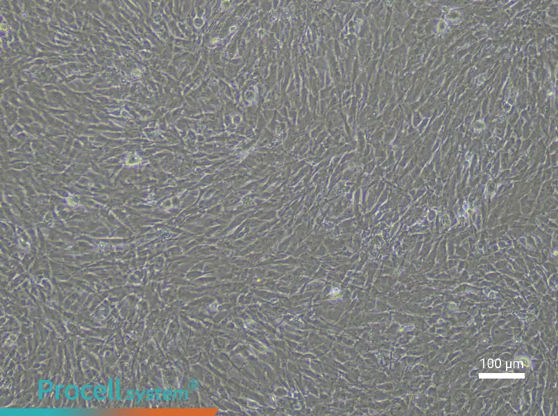 Rabbit Aortic Smooth Muscle Cell Complete Medium - 2