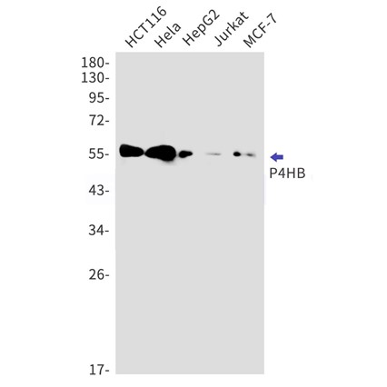 Recombinant P4HB Monoclonal Antibody - 1
