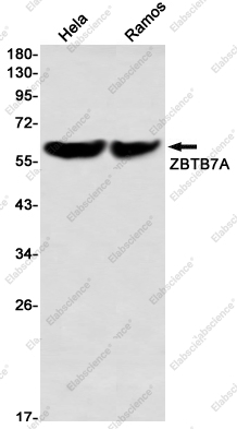 Recombinant ZBTB7A Monoclonal Antibody - 1
