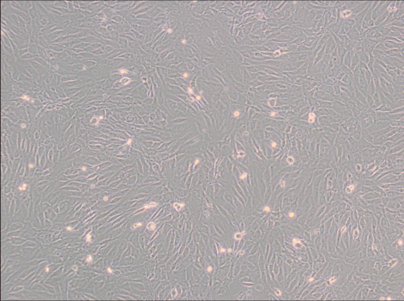 SW 982 [SW-982, SW982] (L15) Cell Complete Medium - 3