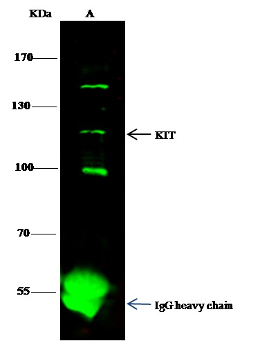 Recombinant KIT/c-KIT/CD117 Monoclonal Antibody - small - 2