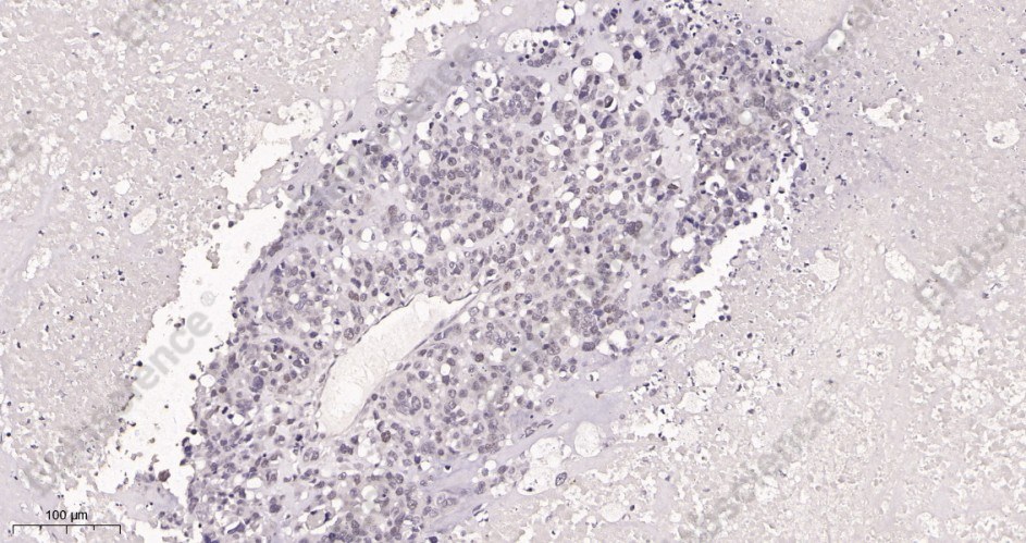 Recombinant c-Myc Monoclonal Antibody - 2