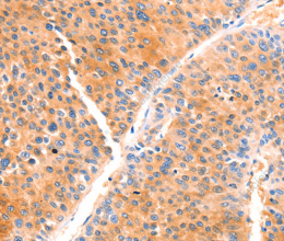 PRDX2 Polyclonal Antibody - 2