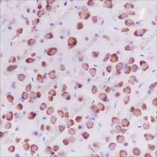 Recombinant LysRS Monoclonal Antibody - 3