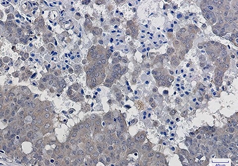 Recombinant IKB beta Monoclonal Antibody - 3