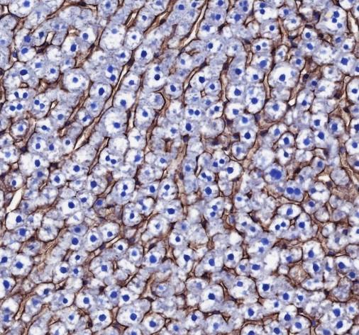 Recombinant Scavenging Receptor SR-BI Monoclonal Antibody - small - 5