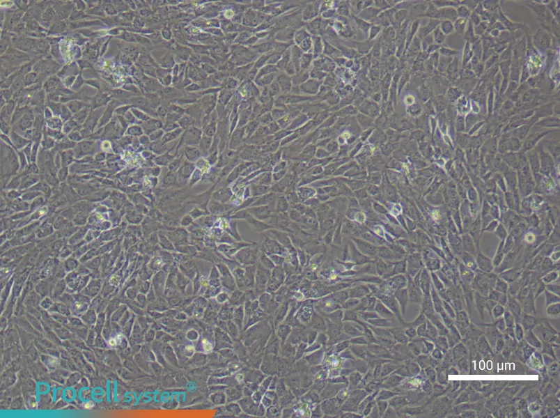 Rat Temporomandibular Joint Chondrocyte Complete Medium - 1
