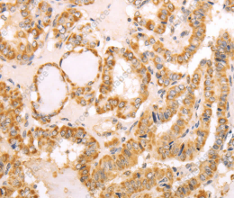 NAMPT Polyclonal Antibody - 3