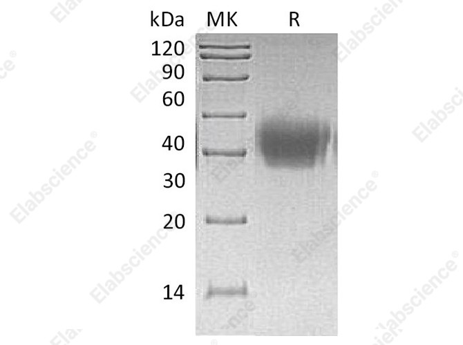 Recombinant Human Activin RIIA/ACVR2A Protein (His Tag) - 1