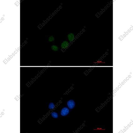 Recombinant SPT5 Monoclonal Antibody - 2