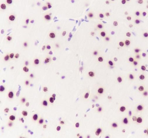 Recombinant CBX4 Monoclonal Antibody - small - 7