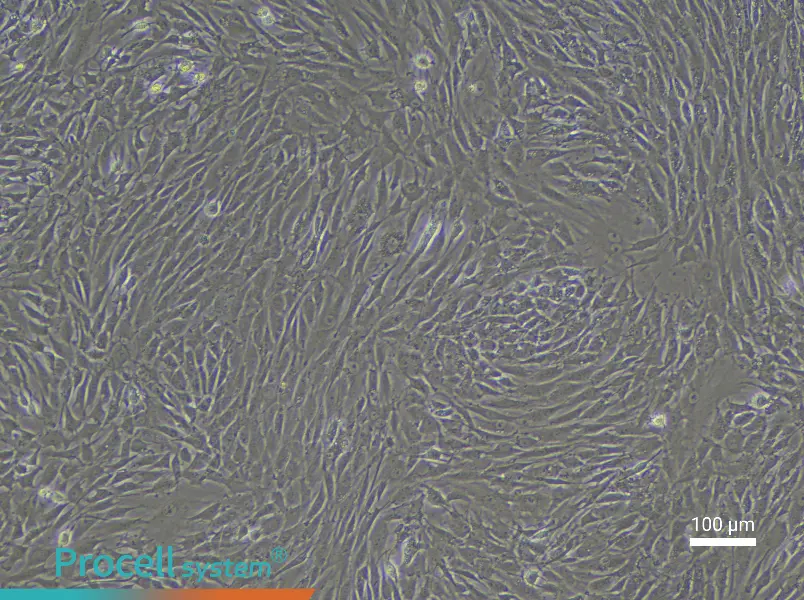Rabbit Synovial Cell Complete Medium - 1