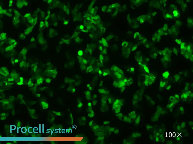 Hep G2-GFPHep G2-GFP - 2