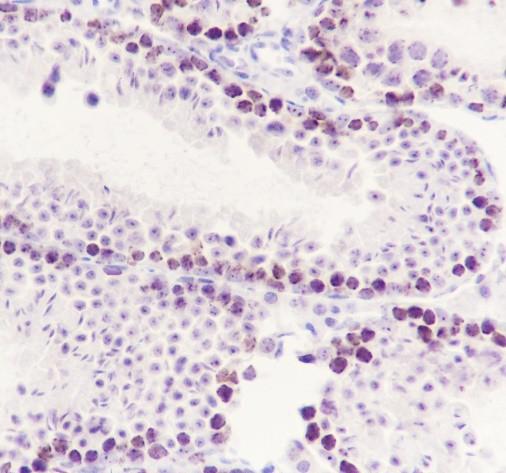 Recombinant SUV39H2 Monoclonal Antibody-searchlist-2