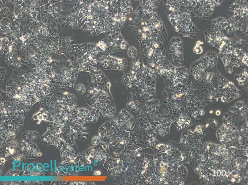 HuH-1 Cell Complete MediumHuH-1 Cell Complete Medium - 2