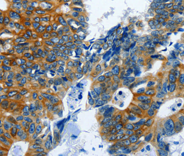 BPIFB3 Polyclonal Antibody - 2
