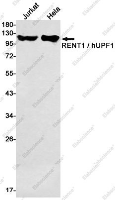 Recombinant RENT1 Monoclonal Antibody - 1