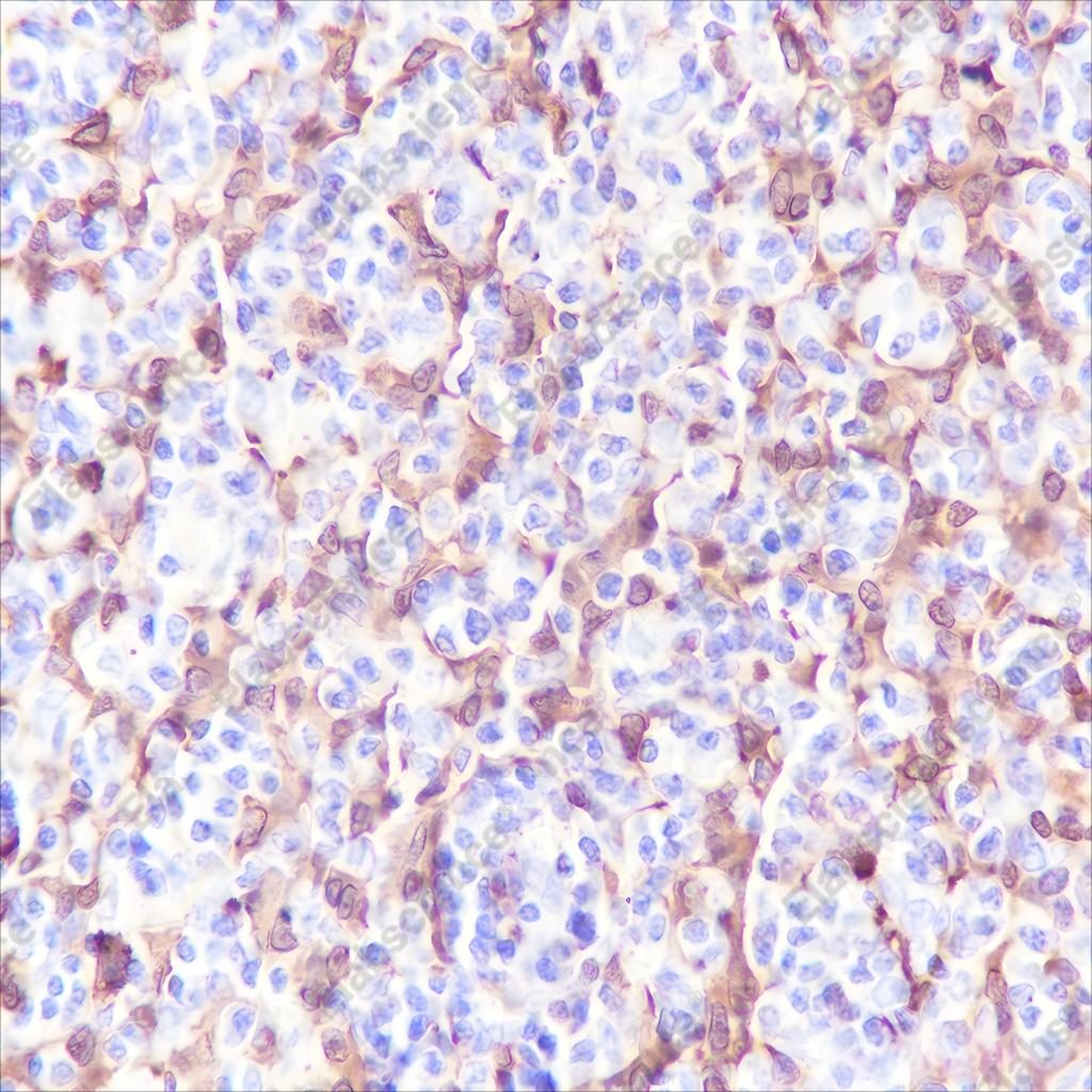 Recombinant S100A8 Monoclonal Antibody - 2