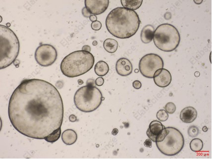 Recombinant Mouse Noggin/NOG Protein (His Tag) - 2