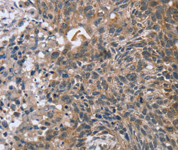 RASSF7 Polyclonal Antibody - 2