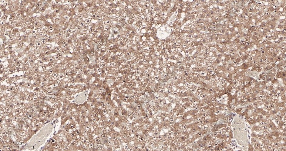 Recombinant Neuropilin 1 Monoclonal Antibody - 3