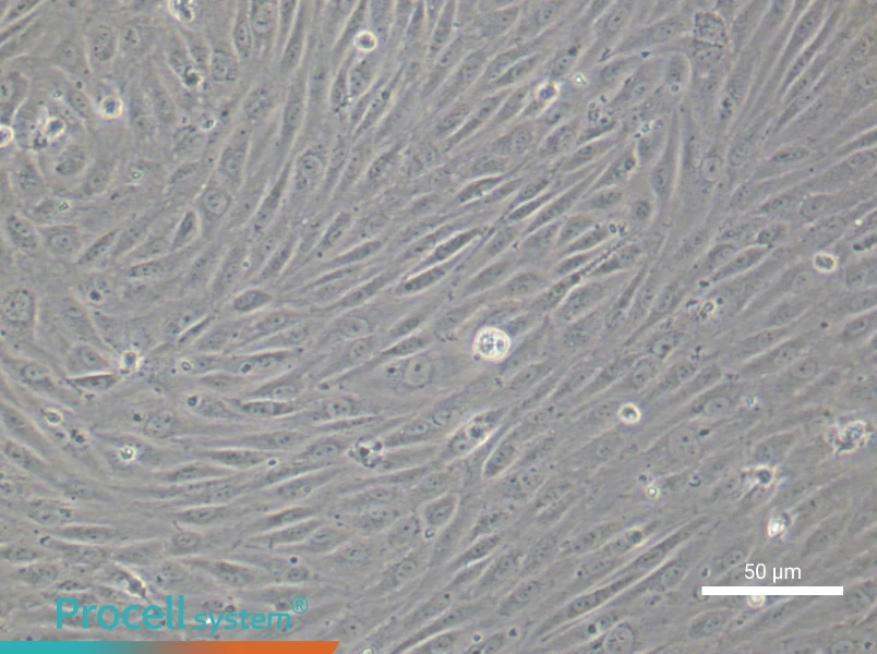 Human Choroidal Microvascular Endothelial Cell Complete Medium - 4