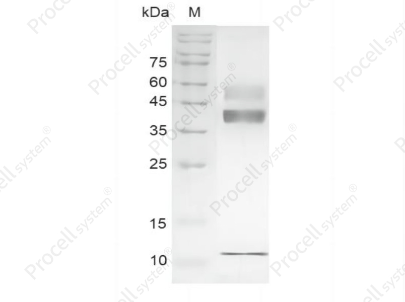 TGF&beta; 1/TGFB1, Human, Recombinant
