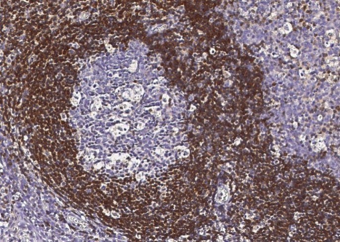 Recombinant Bcl-2 Monoclonal Antibody - small - 2