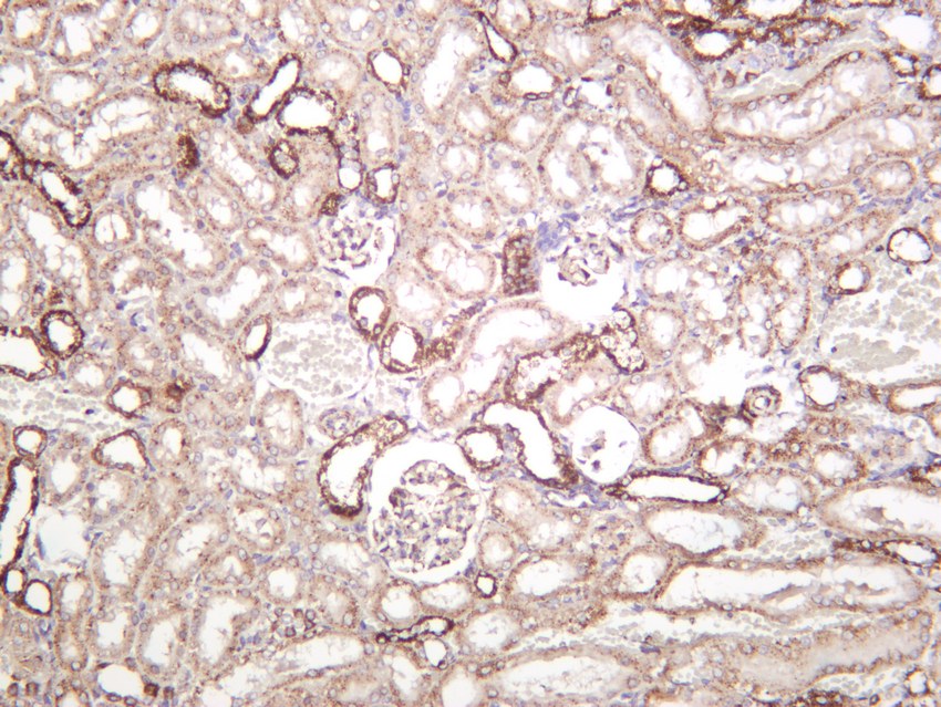 Recombinant SOD2 Monoclonal Antibody - small - 6