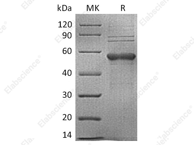 Recombinant Human TIM-3/HAVCR2 Protein (mFc Tag) - 1
