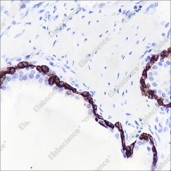 Recombinant Keratin 15 Monoclonal Antibody - 4