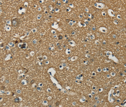 NEMF Polyclonal Antibody - 2