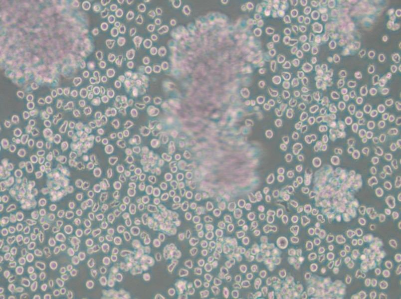 Granta-519 Cell Complete Medium - 5