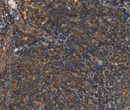 PLIN2 Polyclonal Antibody - 3