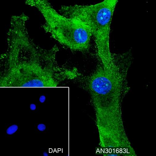 Recombinant RMP/C19orf2 Monoclonal Antibody - small - 4