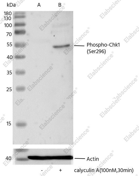 Recombinant Phospho-Chk1 (Ser296) Monoclonal Antibody - 1