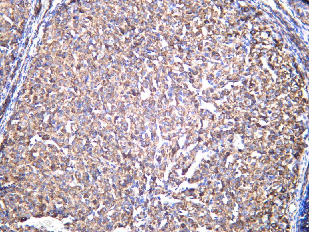 Recombinant SFRP4 Monoclonal Antibody - 3