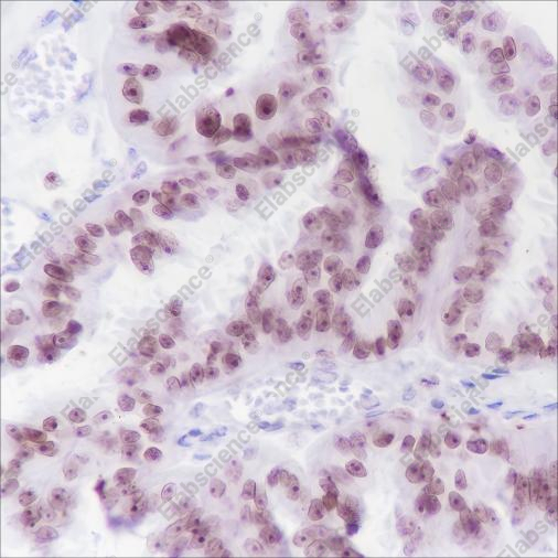 Recombinant Cleaved PARP1 p25 Monoclonal Antibody - 3