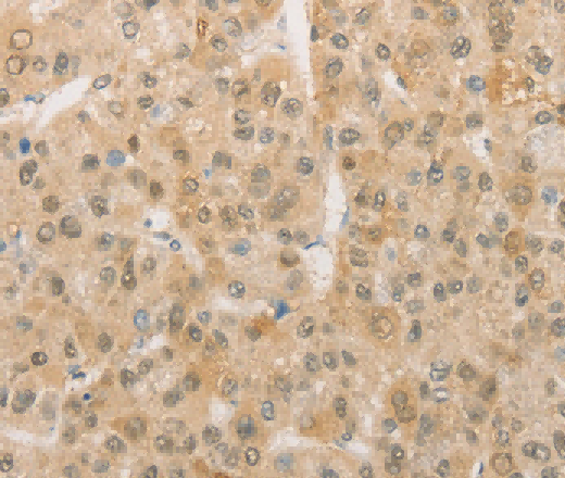 PGK2 Polyclonal Antibody - 3